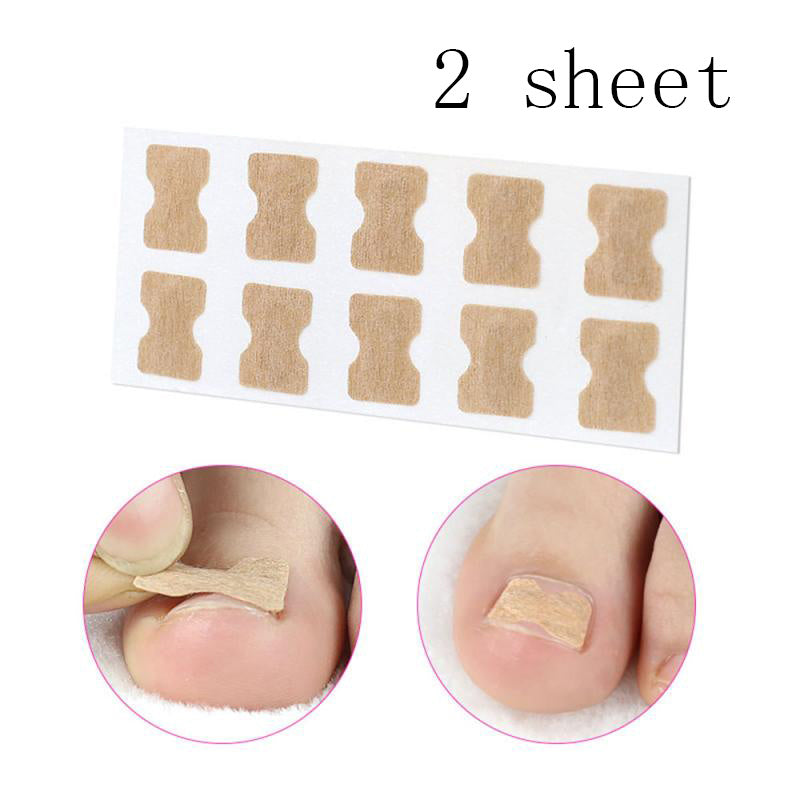 Adhesive-Free Orthopedic Nail Correction Device - PET Plastic | Inlaid Armor Roll System