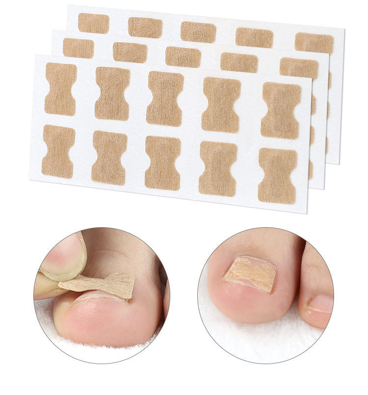 Adhesive-Free Orthopedic Nail Correction Device - PET Plastic | Inlaid Armor Roll System