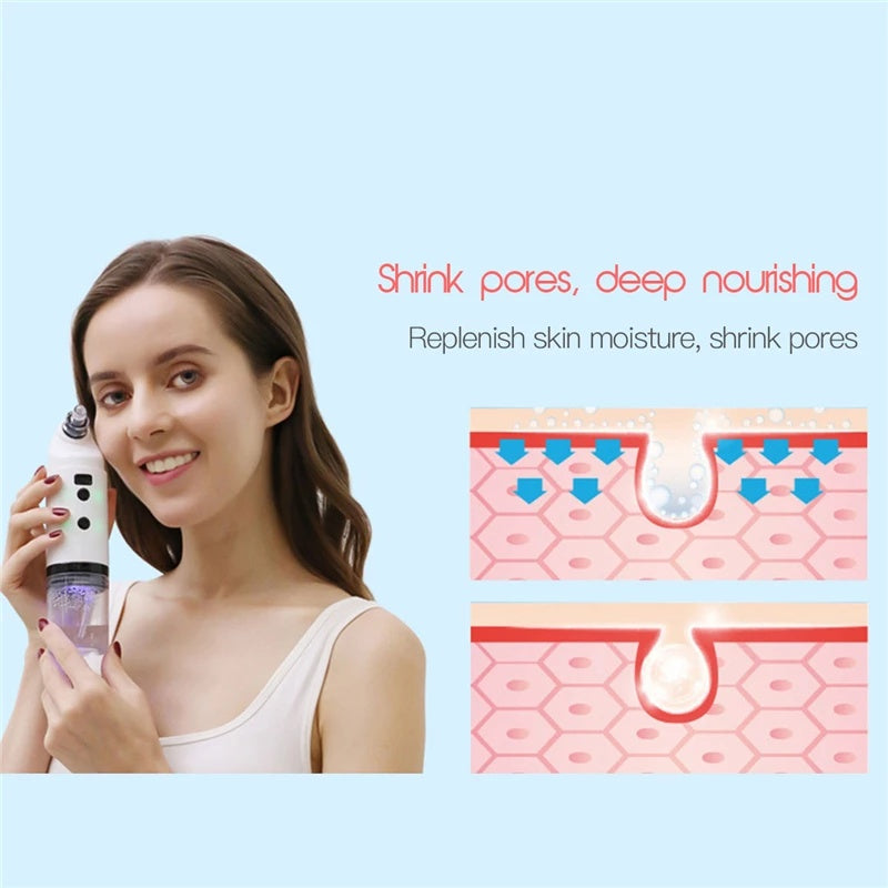 Elektrisk ansiktsrengöring Dammsugare Blackhead Ance Remover Krympporer Återfuktande Ansikte Hudvård Peeling Device