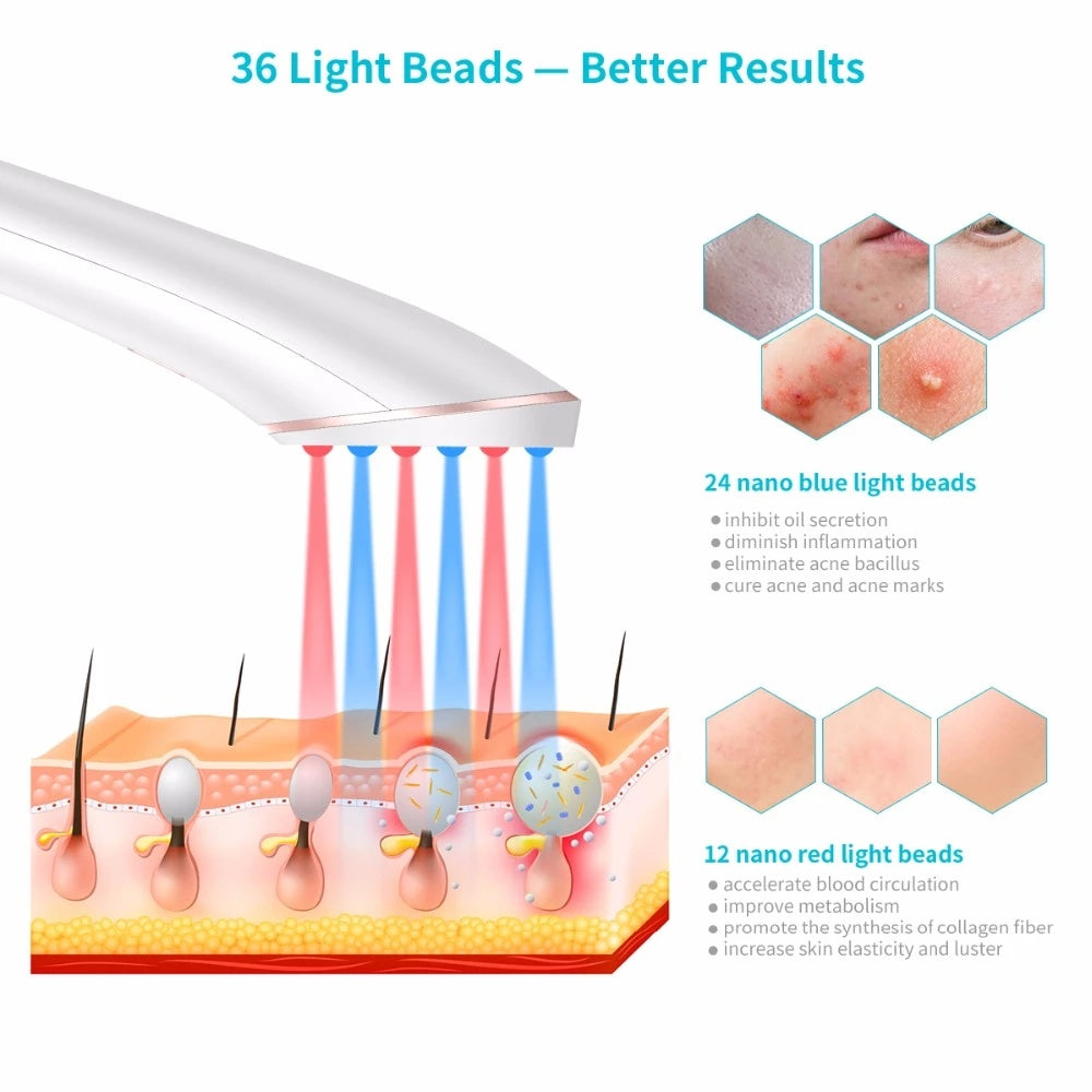 Acne Light Therapy Device - Wireless Rechargeable Blue & Red Light Treatment