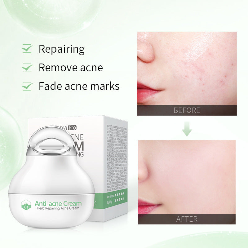 Pommade à base de plantes, crème hydratante pour le visage, produits de soins de la peau