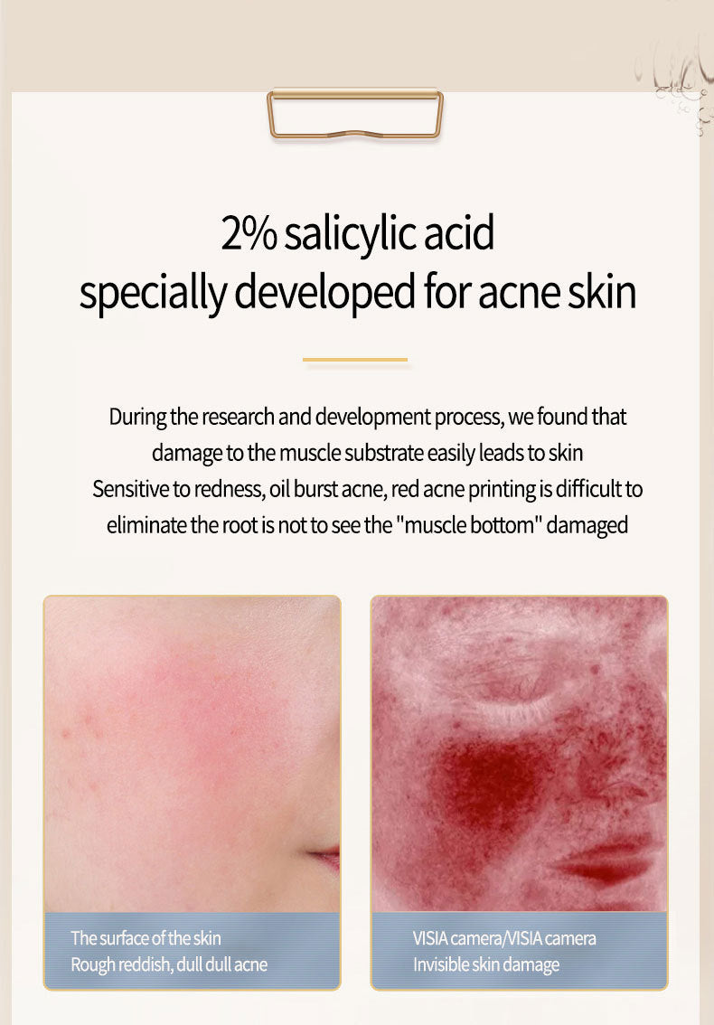 Acneborttagning av salicylatprodukter