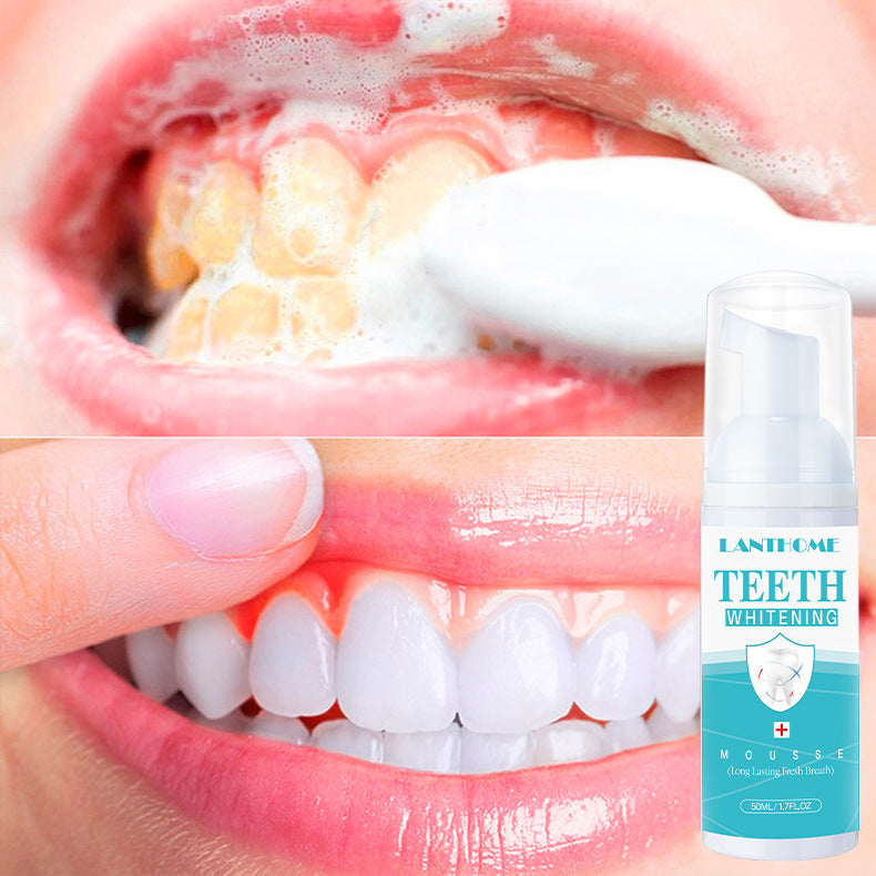 Tandblekningsmousse Rengöring Tandvård Oral Cleaning Care Skum