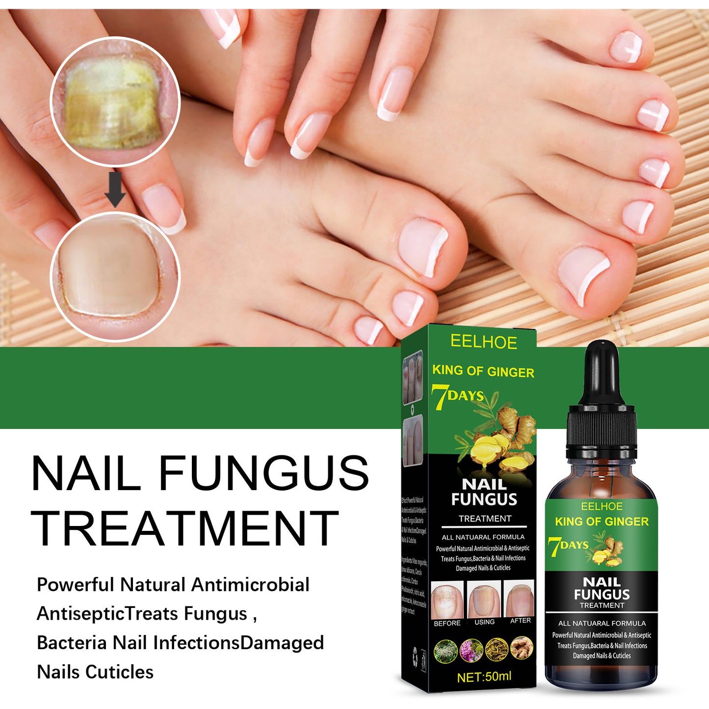 Professional Nail Repair Solution - Advanced Hand & Foot Care Treatment | Natural Formula 50ml