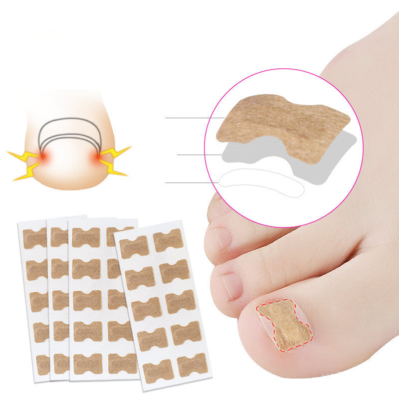 Adhesive-Free Orthopedic Nail Correction Device - PET Plastic | Inlaid Armor Roll System