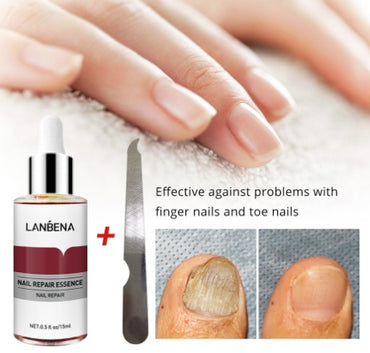 Professional Nail Repair Essence - 12ml Salicylic Acid Formula | 3-4 Drops Twice Daily