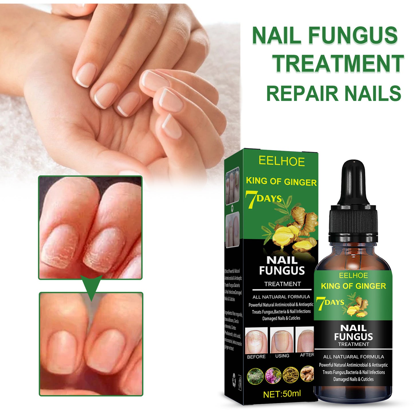 Professional Nail Repair Solution - Advanced Hand & Foot Care Treatment | Natural Formula 50ml