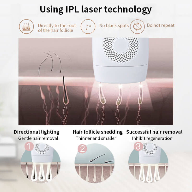 990,000 IPL Laser Hair Removal Device - LCD Display 5-Gear Professional System