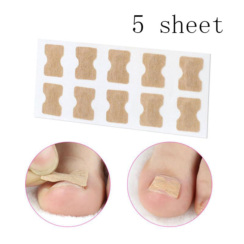Adhesive-Free Orthopedic Nail Correction Device - PET Plastic | Inlaid Armor Roll System