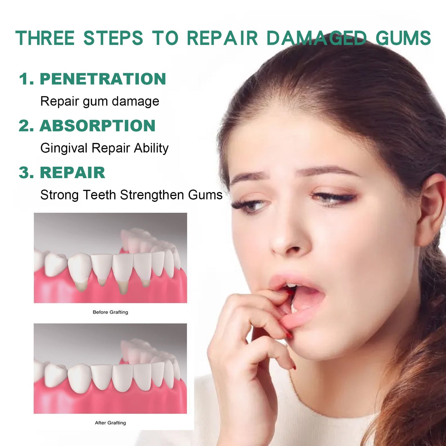 Gouttes de réparation des gencives, soins, soulagement des gencives, mousse parodontale, nettoyage buccal, gouttes