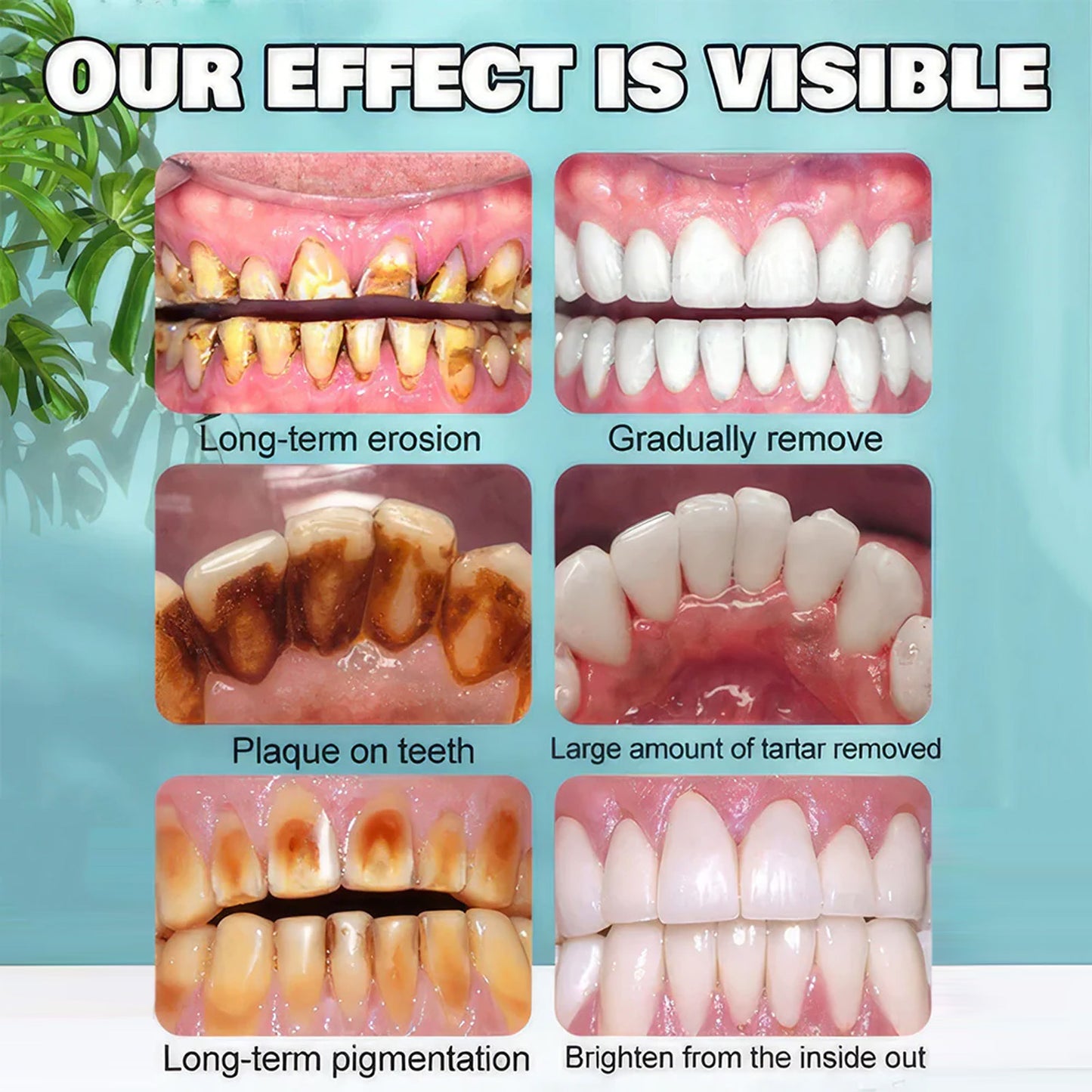 Whitening Tandkräm Rengöring Whitening Oral Care