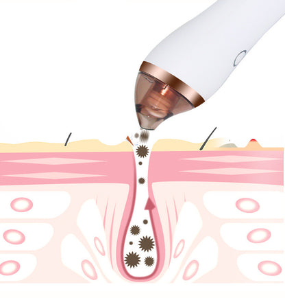 4 in 1 kropp Guasha Cupping Blackhead Remover Machine Facial Pore djup rengörande skönhet hudvård