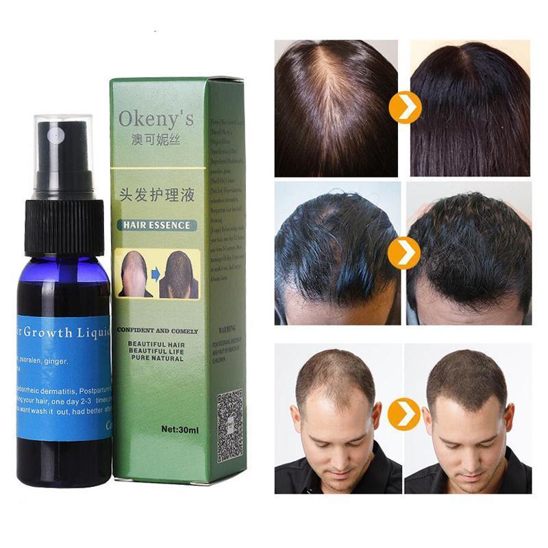 Produits de croissance de cheveux Sunburst pour femmes et hommes produits anti-perte de cheveux alopécie calvitie croissance de l'huile de barbe spray de croissance des cheveux