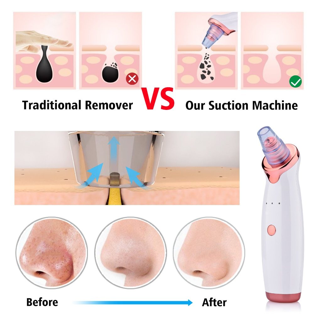 Blackhead Remover Skin Care Face Clean Pore Vacuum Acne Pimple Removal Vacuum Suction Facial Diamond Dermabrasion Tool Machine