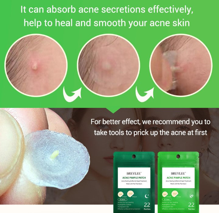 Tea Tree Acne Patch Tonar aknemärken och ultratunt