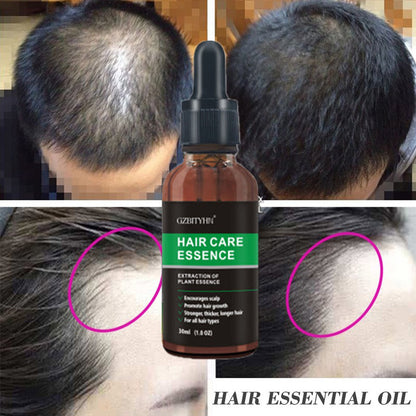 Hair Growth Oil Hair Growth Oil Oem Hårvård eterisk olja