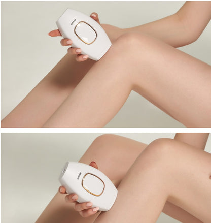 Complete Body Electric Hair Removal System - Multi-Function Home Beauty Device