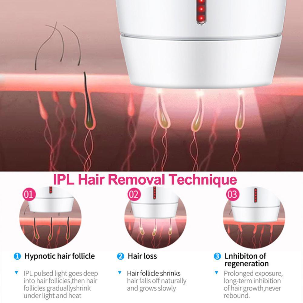 Home Laser Hair Removal Instrument - 800,000 Flash 36W Global System