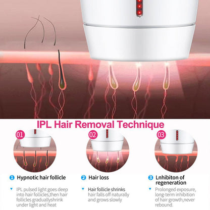 Home Laser Hair Removal Instrument - 800,000 Flash 36W Global System