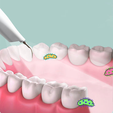 Ultrasonic Teeth Cleaner Bärbar munvårdsvattentandpetare