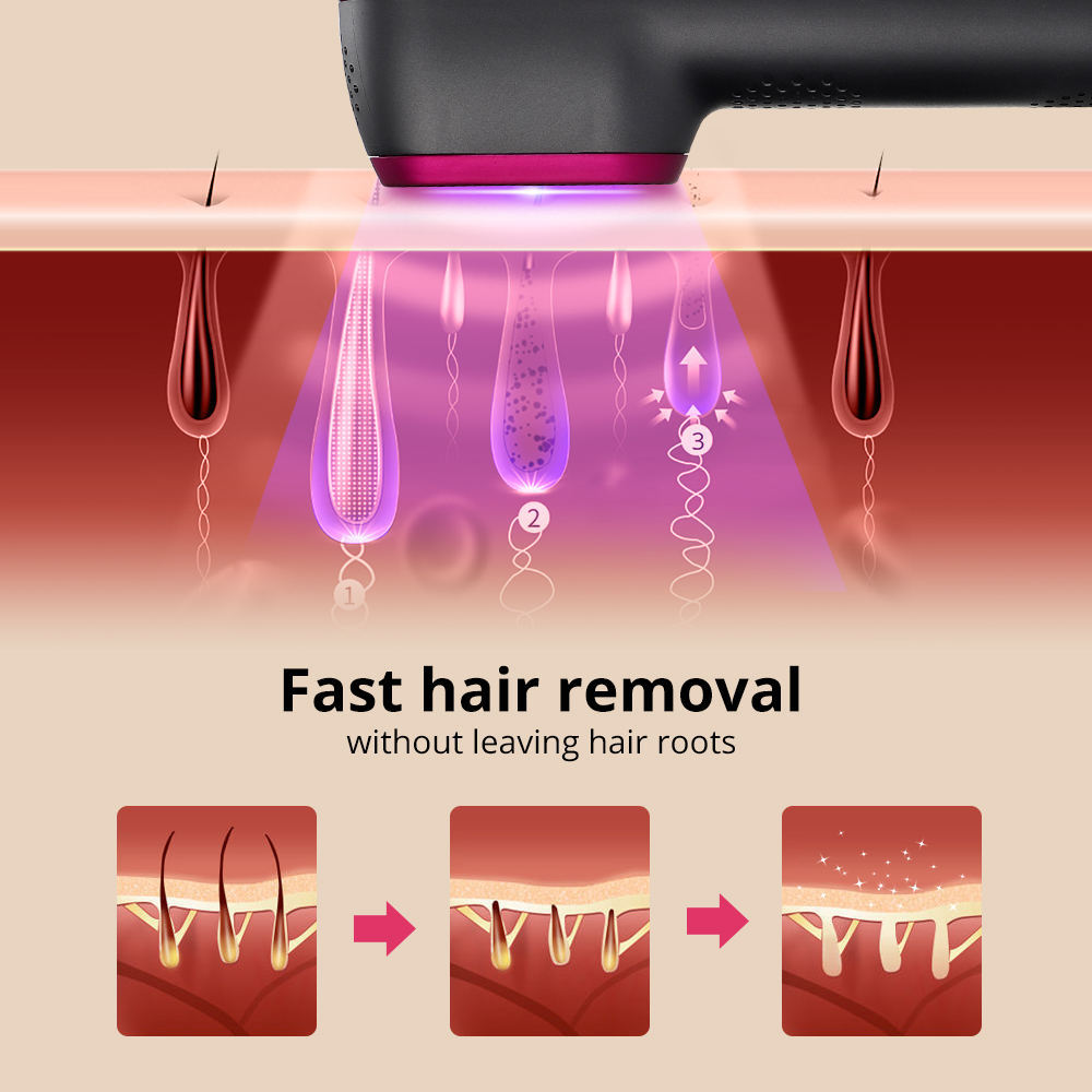 High-Capacity IPL Hair Removal - 100,000 Flash Professional System for All Genders