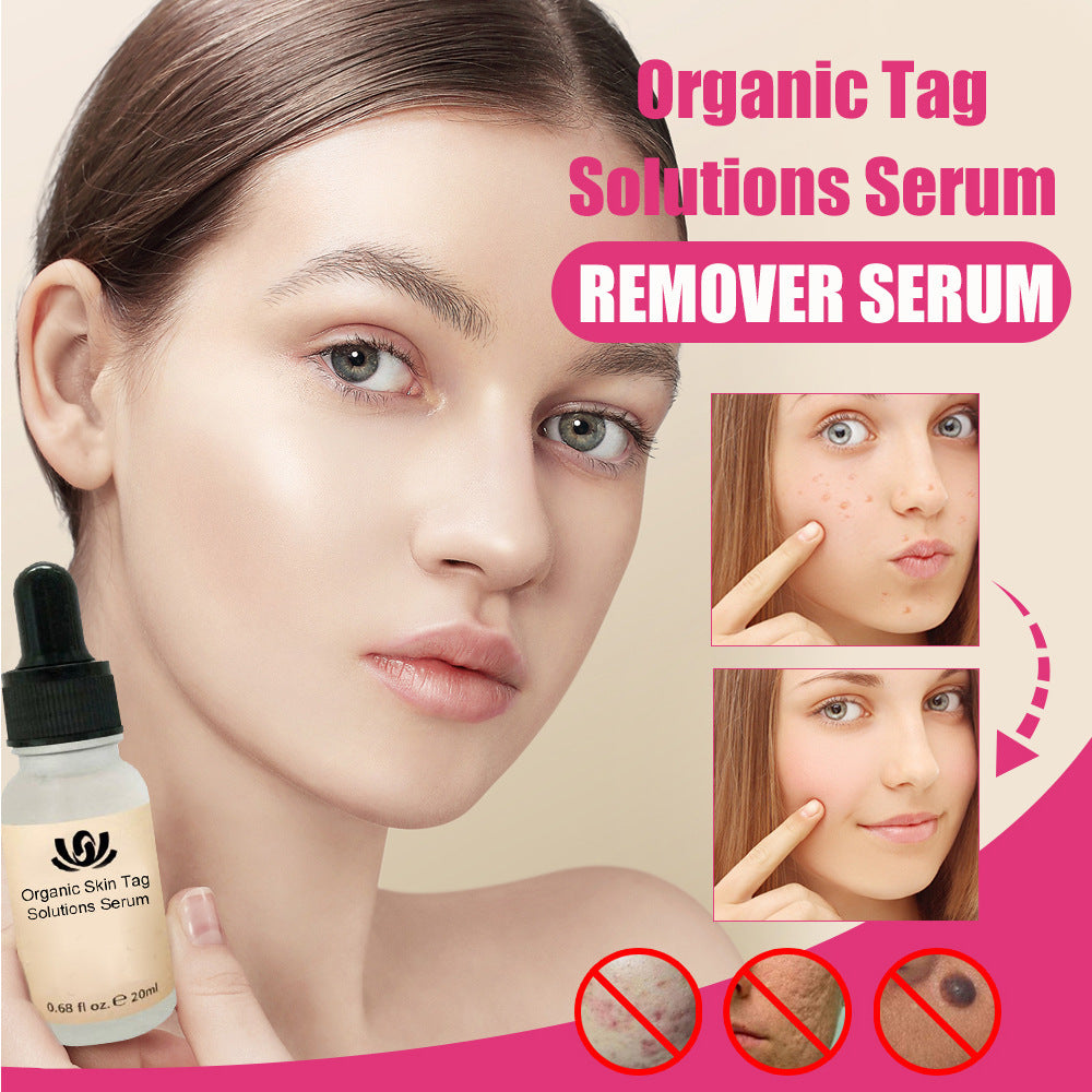 Crème anti-taupes pour le visage aux huiles essentielles de dessalement et de réparation