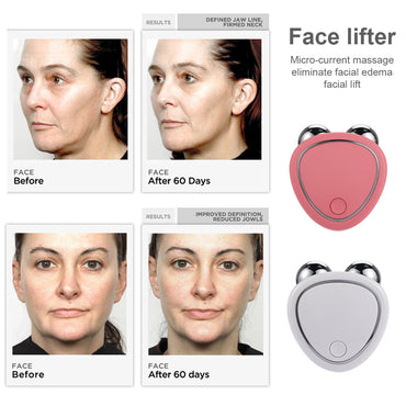 Micro-Current Beauty Instrument - Ultrasonic Ion Facial Device