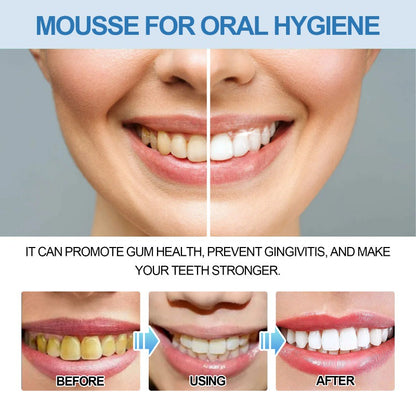 Oral Cleaning Mousse Whitening Teeth Care Gum