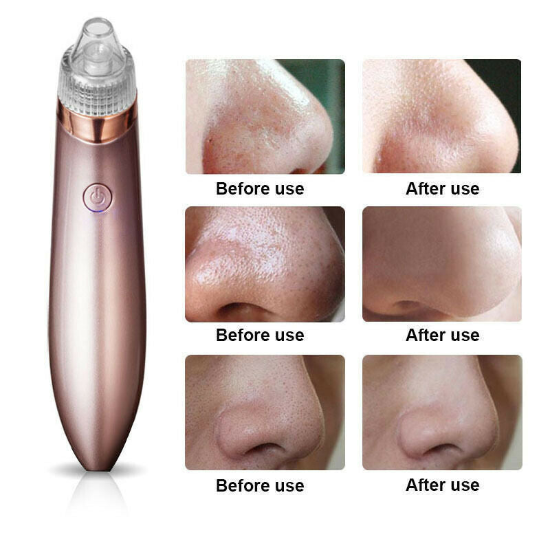 Electric Blackhead Vacuum Pore Cleaner Acne Pimple Remover Strong Suction Tool Electric Blackhead Remover Pore Vacuum Suction Diamond Dermabrasion Face Cleaner